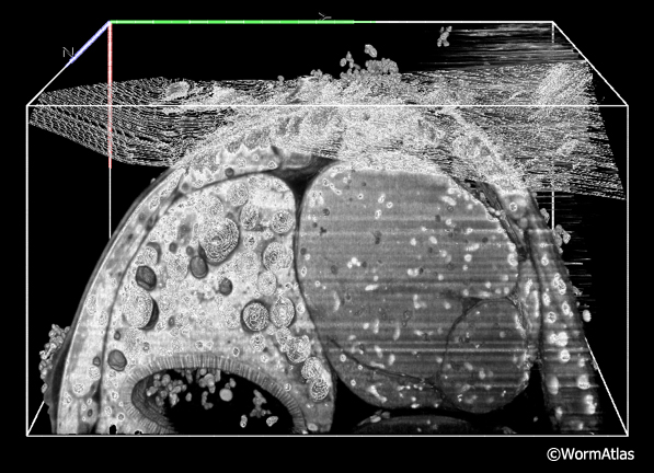 EMFIBSEMFIG 3: FIB/SEM imaging.